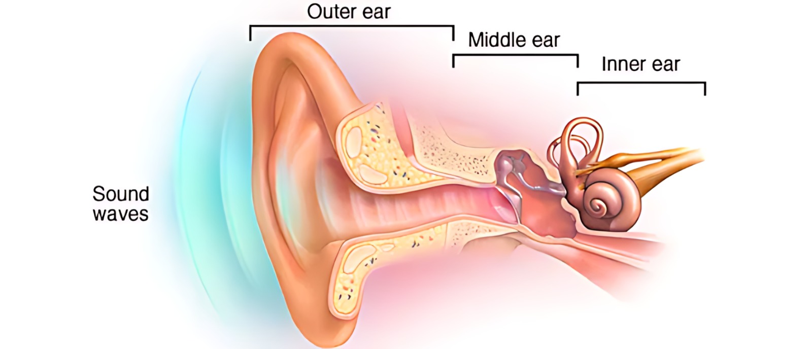 Aanvii Hearing explains how an audiogram reveals the type of hearing loss and helps guide treatment decisions.